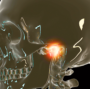 TMJ Therapy